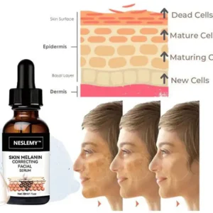 ✨Fast Dark Spot Remover-NESLEMY™ Melanin Correcting Facial Serum