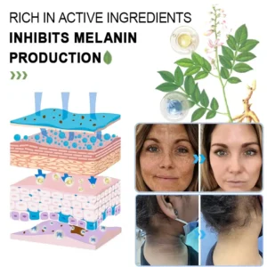 NESLEMY™ Purifying Exfoliating Gel for Acanthosis Nigricans, Exfoliation, Dark Spots, Skin Tags, and Eczema