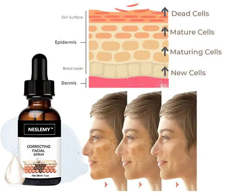 2025s,NESLEMY™ Fast Dark Spot Remover ✨ Where science meets luxury. Our melanin-correcting serum erase